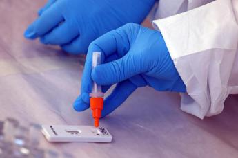 Test Covid, istruzioni per l’uso. I consigli dei microbiologi: “Ma no al tamponificio”