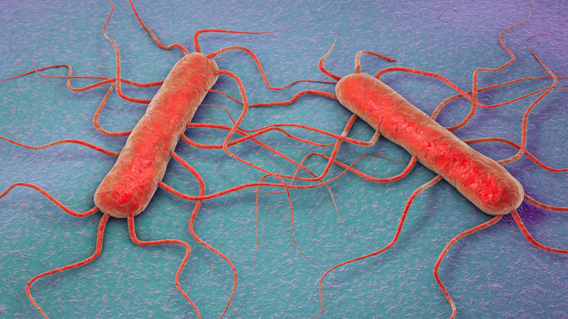 Listeria, allarme in Francia e richiami in Italia: due morti e ritiri di prodotti dai supermercati