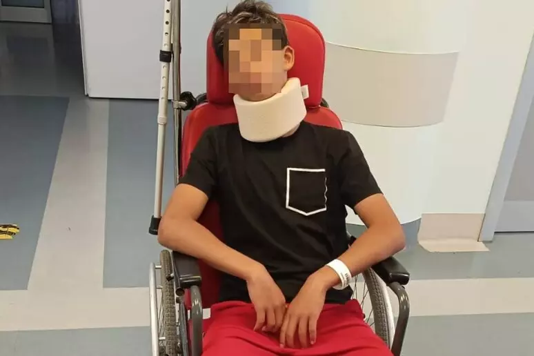 Collegno, papà irrompe in campo e picchia un portiere 13enne: fratture al volto Collegno, papà irrompe in campo e picchia un portiere 13enne: fratture al volto