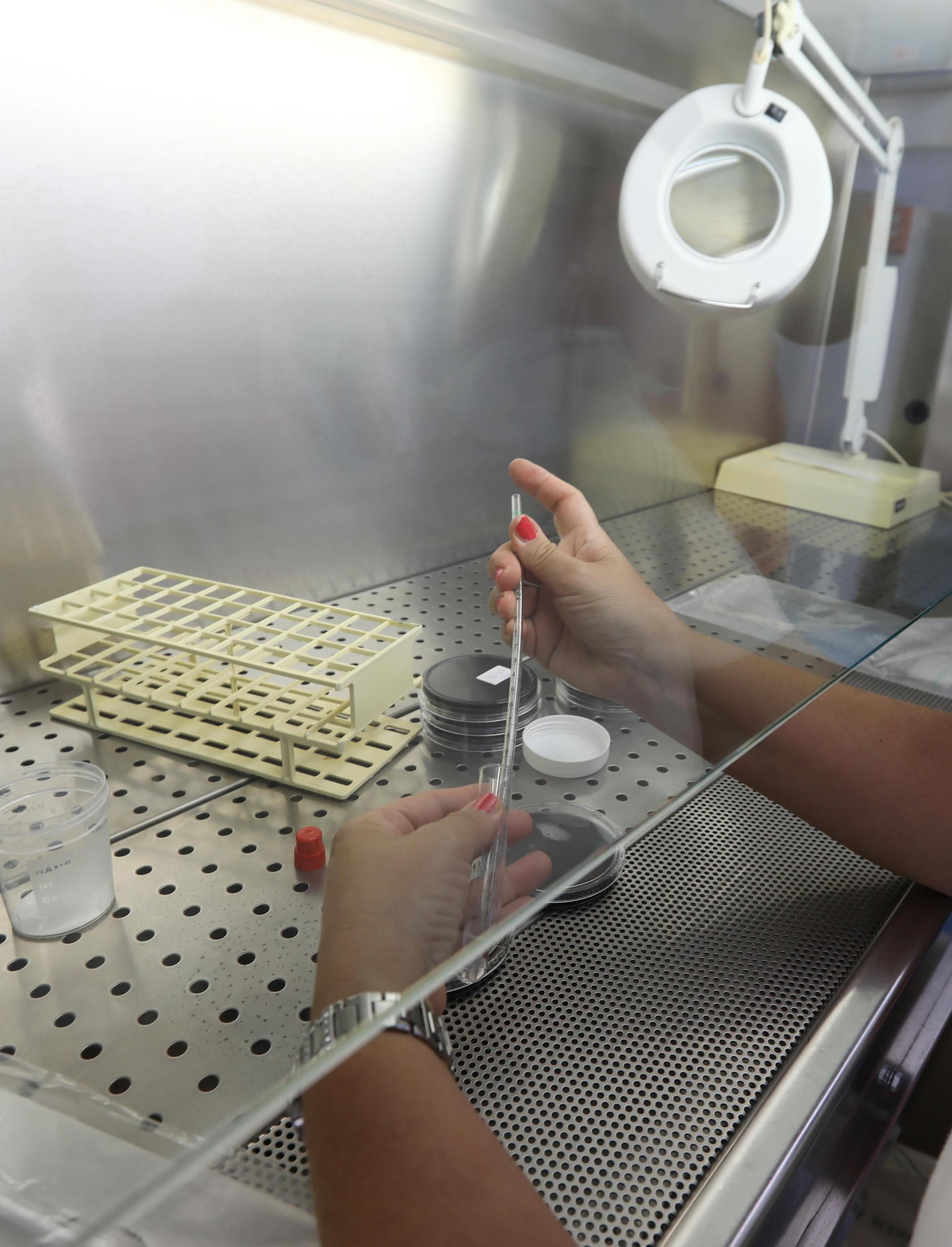 In Italia salgono i casi di legionella: cos’è e dove vive il batterio